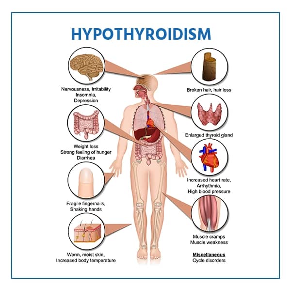 thyroid treatment without medicine for woman 