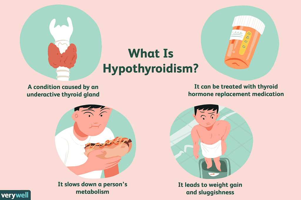 low thyroid treatment