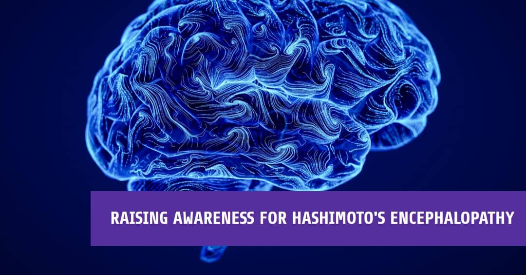 ms and hashimoto's encephalopathy