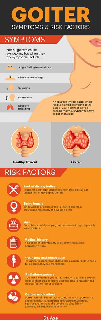 swollen thyroid treatment