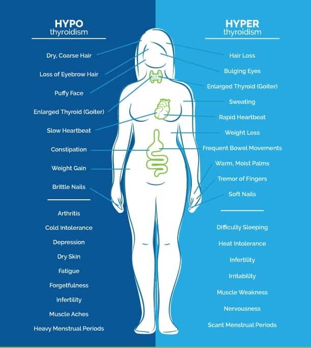 Top 10 Facts About Thyroid Hypothyroidism and Puffy Eyes