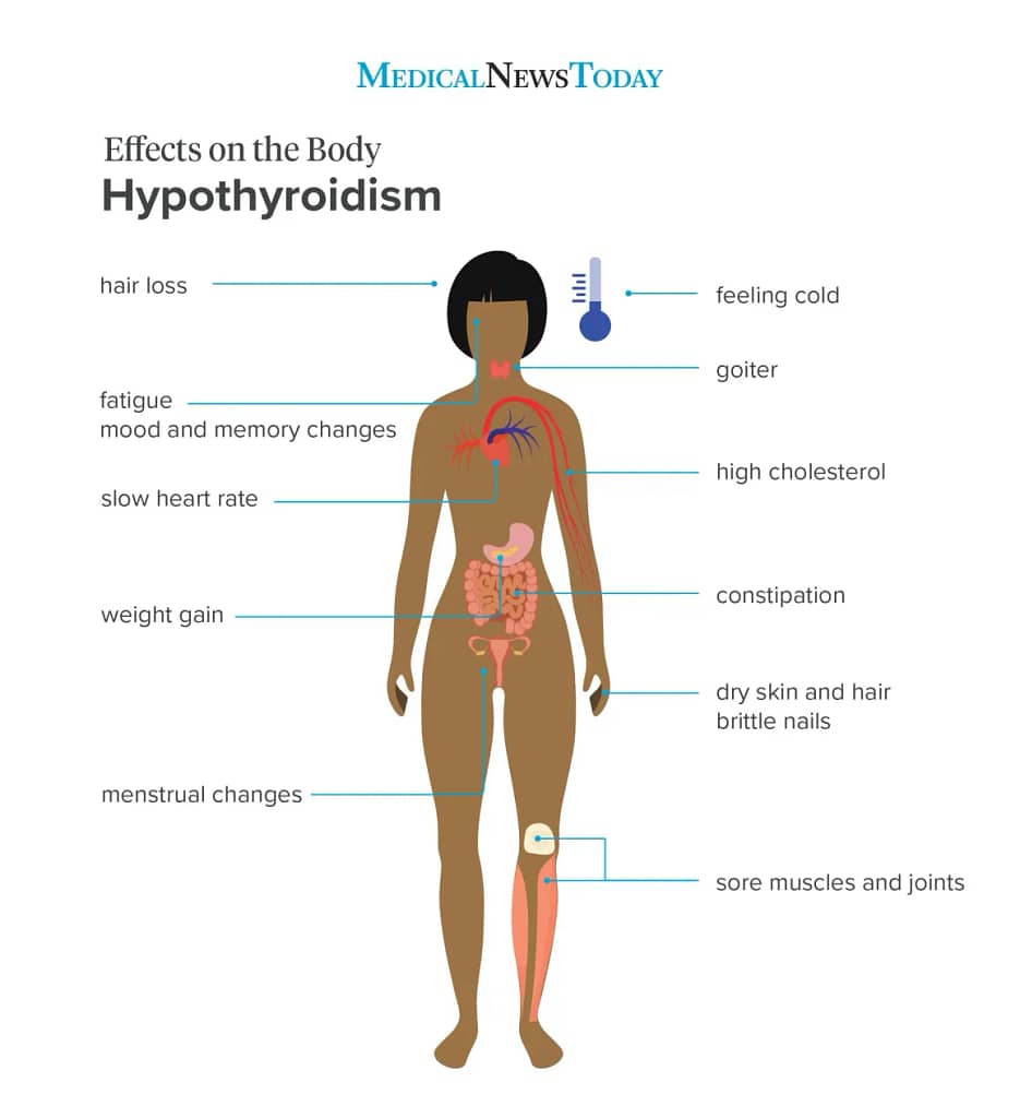 Symptoms of Thyroid Issues